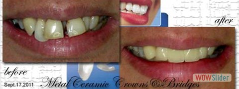 smile_makeover11