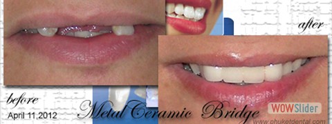 smile_makeover14