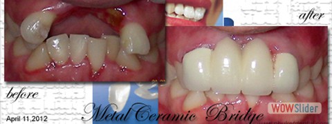 smile_makeover15