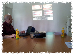 Natural Plus Tooth Whitening in Phuket,Thailand