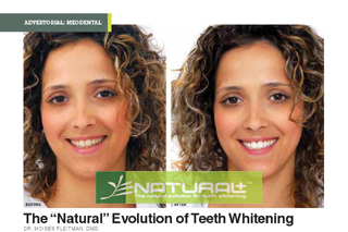 Natural Plus Tooth Whitening in Phuket,Thailand
