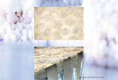 Natural Plus Tooth Whitening at Phuket Dental Clinic,Thailand