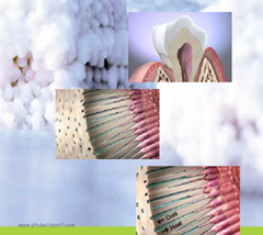 Natural Plus Tooth Whitening at Phuket Dental Clinic,Thailand